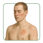 Antiallergiques