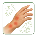 Antimicrobien