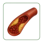 Cholestérol