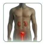 Infection urinaire